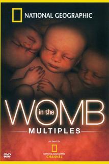 Profilový obrázek - In the Womb: Multiples