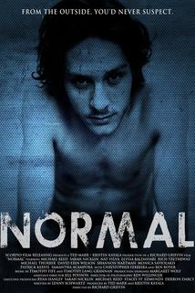 Normal  - Normal