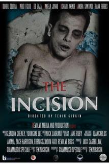 The Incision