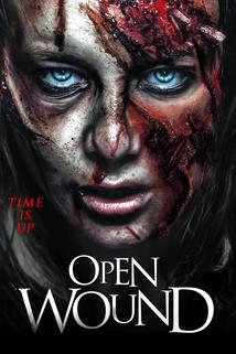 Open Wound the Ueber: movie
