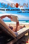 Sundown: The Melanoma Truth 