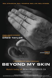 Profilový obrázek - Beyond My Skin