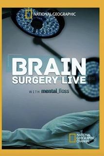 Profilový obrázek - Brain Surgery Live with Mental Floss