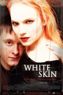 Bílá kůže