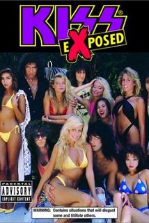 KISS: eXposed