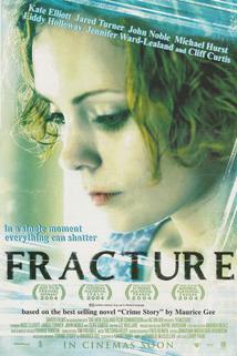 Fracture  - Fracture