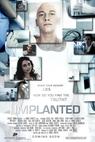 Implanted 