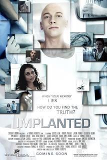 Implanted  - Implanted
