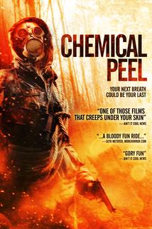 Profilový obrázek - Chemical Peel