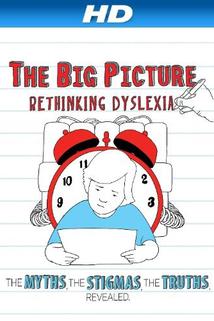 Profilový obrázek - The D Word: Understanding Dyslexia