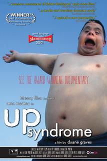 Profilový obrázek - Up Syndrome